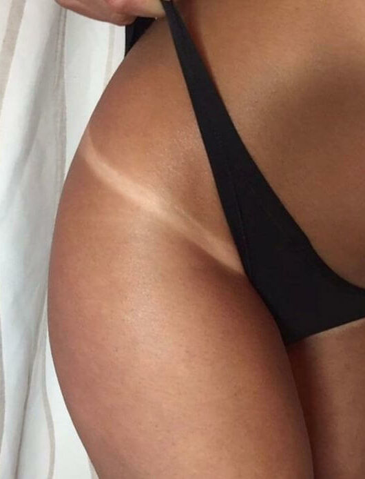 tan lines dark