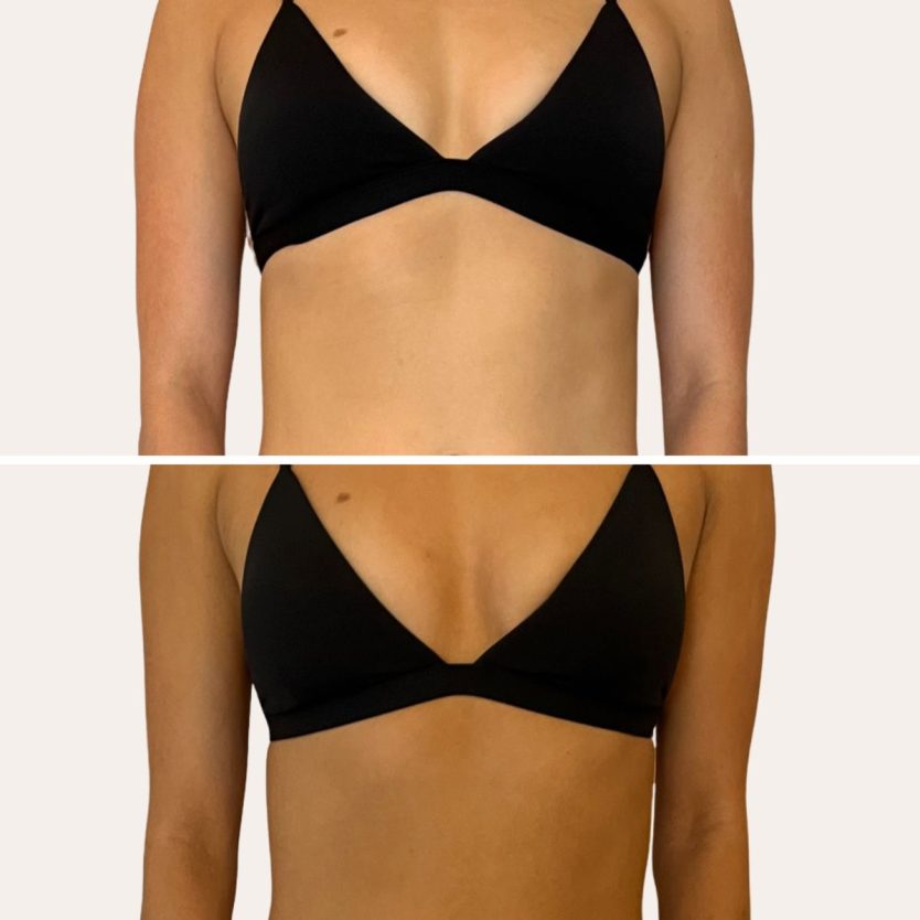 sunfx before and after results from self tanning collection Self tanning water for all skin tones and type