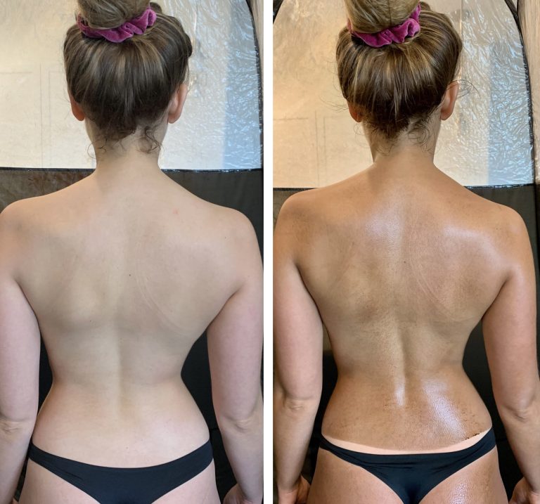 Sunfx before and after